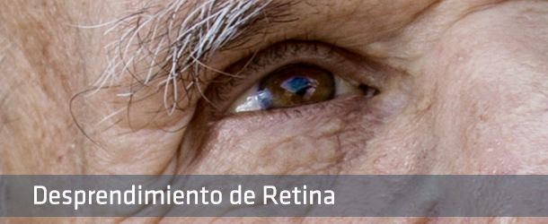 Cirugía Desprendimiento de Retina - VERTE Oftalmología Barcelona