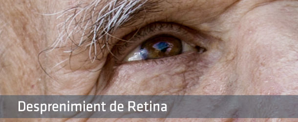 Cirurgia Despreniment de Retina - VERTE Oftalmología Barcelona