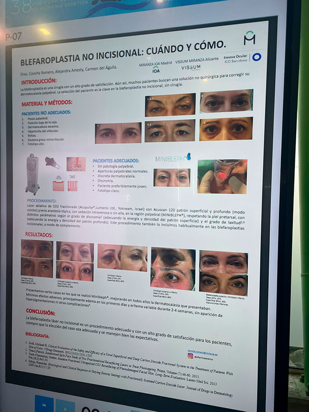 Dra. Carmen Del Águila - Blefaroplastia - Oculoplastia - VERTE Oftalmología Barcelona
