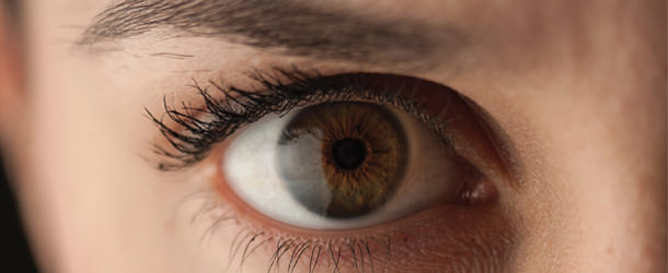Tratamiento arrugas ojos - VERTE Oftalmología Barcelona