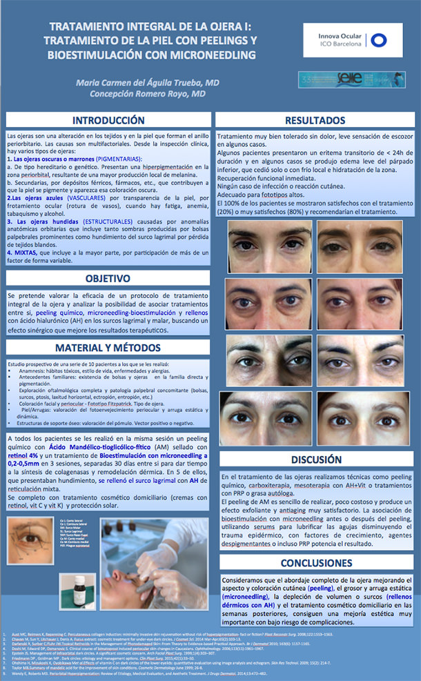 Poster Dra. Carmen Del Águila - Tratamiento Integral de la ojera - VERTE Oftalmología Barcelona
