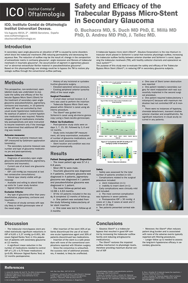 Micro-Stent - VERTE Oftalmología Barcelona