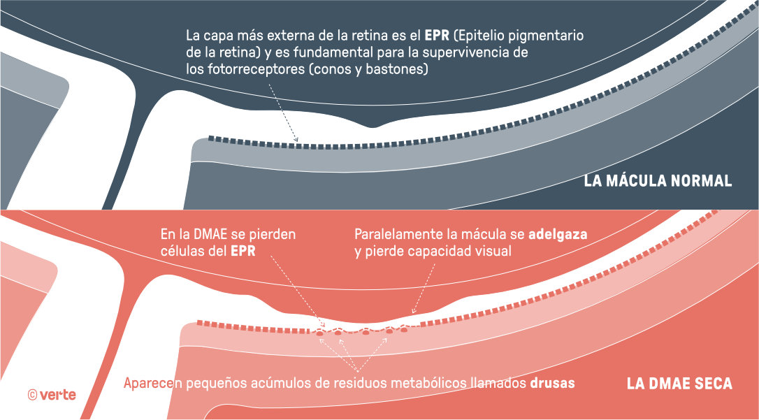 DMAE seca - Verte Oftalmologia Barcelona