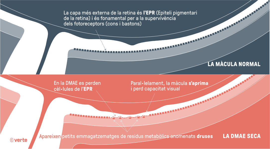 DMAE seca - Verte Oftalmología Barcelona